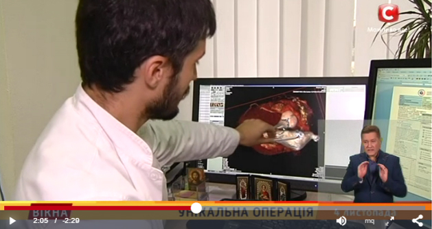 унікальна операція