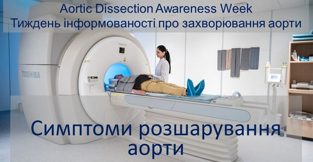 розшарування аорти
